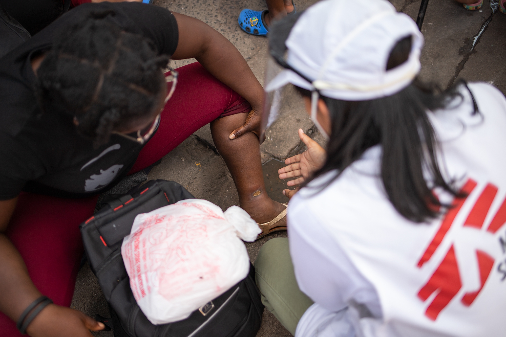 Mahli, mujer haitiana de 38 años de edad que viaja junto a su hijo y esposo, muestra sus piernas con picaduras de insectos que se han infectado a una médica de la organización Médicos Sin Fronteras. Comayagüela, 28 de octubre de 2021. Foto: Martín Cálix.